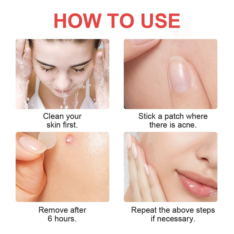 Hydrocolloid Invisible Acne Patch